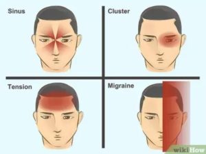7 उपाय- जिससे आप माइग्रेन और सिर दर्द को हमेशा केलिए कर सकते हैं खतम